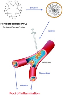 Monitoring inflammatory processes with PFCs