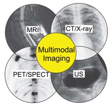 Multimodal imaging