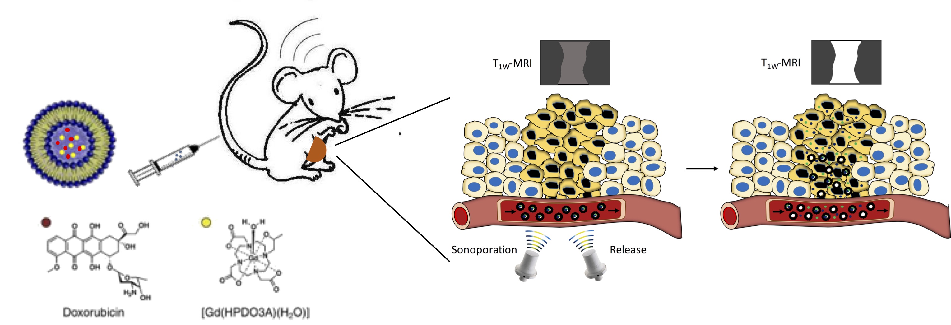 MRI visualisation of drug delivery/release