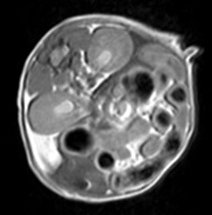 generic MRI image